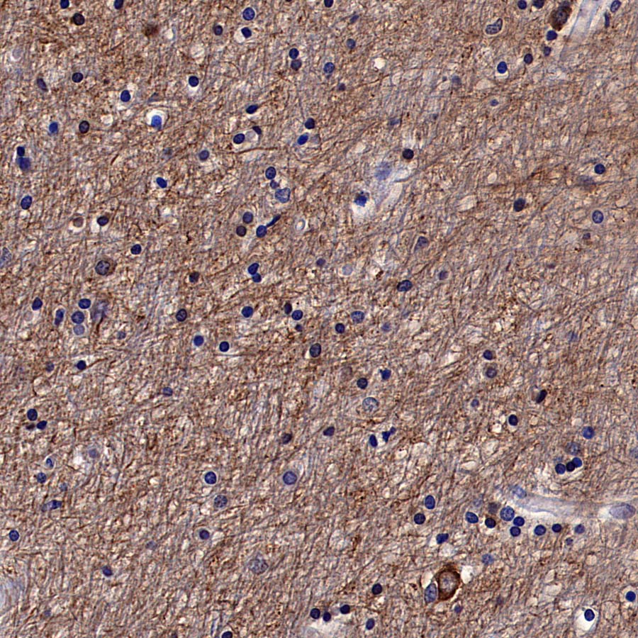 RPS3 Recombinant Rabbit mAb (S-4121-27)