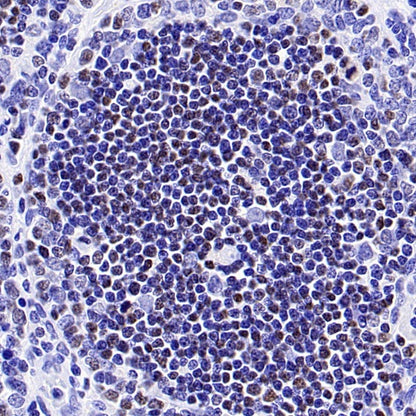 Ctip2 Recombinant Rabbit mAb (S-1375-21)