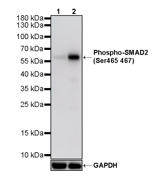Phospho-SMAD2 (Ser465/467) Recombinant Rabbit mAb (S-6222)