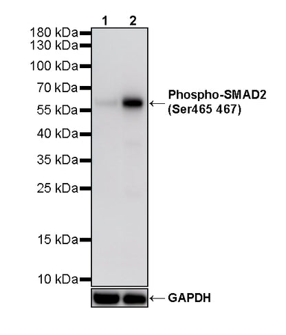 Phospho-SMAD2 (Ser465/467) Recombinant Rabbit mAb (S-6222)