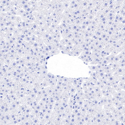 TBR1 Recombinant Rabbit mAb (S-1102-34)