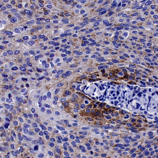 Bim Recombinant Rabbit mAb (S-994-29)