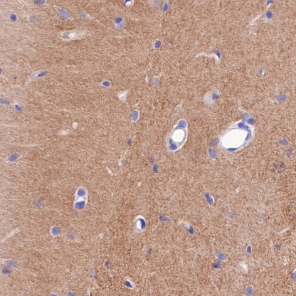 Nectin-1/PVRL1 Recombinant Rabbit mAb (S-279-140)