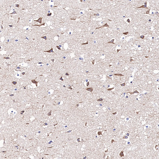 Amyloid Precursor Protein Recombinant Rabbit mAb (S-806-13)