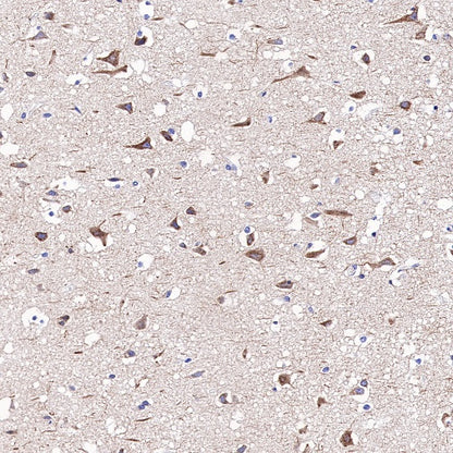 Amyloid Precursor Protein Recombinant Rabbit mAb (S-806-13)