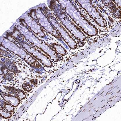 Histone H4 (acetyl K5) Recombinant Rabbit mAb (S-1464-112)