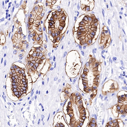 TACSTD2/TROP2 Recombinant Rabbit mAb (S-R237)