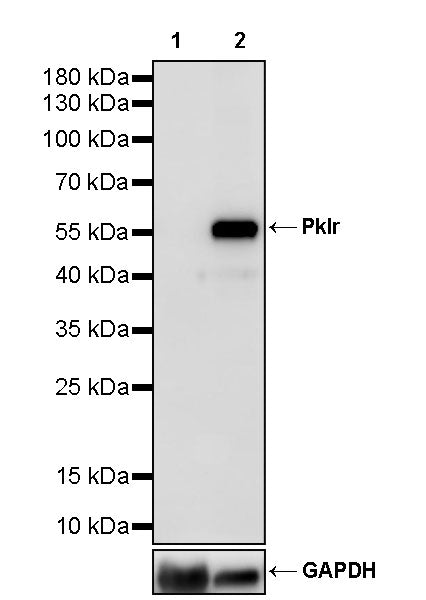 Pklr Recombinant Rabbit mAb (S-4114-40)