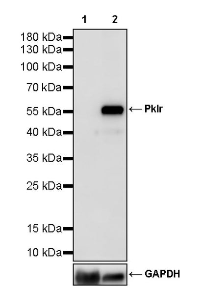 Pklr Recombinant Rabbit mAb (S-4114-40)