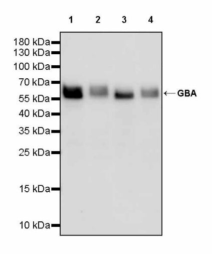 GBA Recombinant Rabbit mAb (S-3211-14)