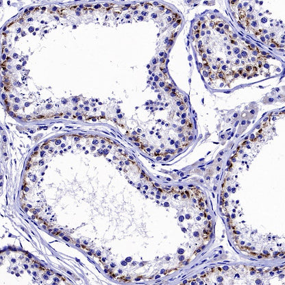Pex14 Recombinant Rabbit mAb (S-2379-8)