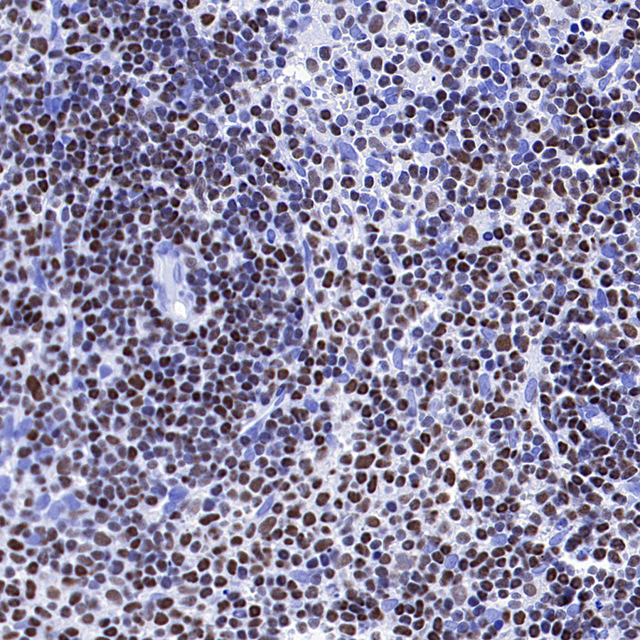 IKZF1 Recombinant Rabbit mAb (S-4176-17)
