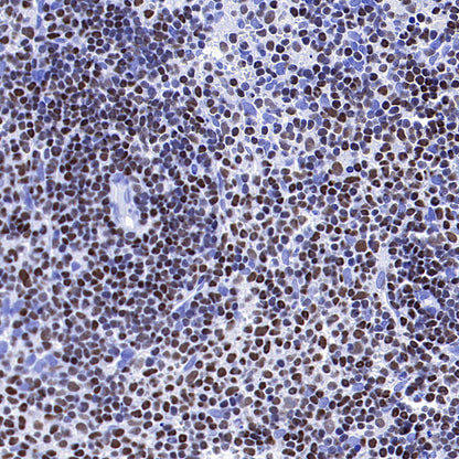 IKZF1 Recombinant Rabbit mAb (S-4176-17)