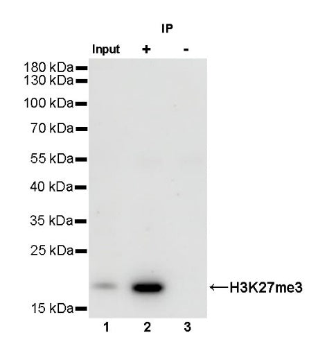 Histone H3 (tri methyl K27) Recombinant Rabbit mAb (SDT-431-118)