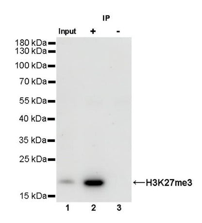Histone H3 (tri methyl K27) Recombinant Rabbit mAb (SDT-431-118)