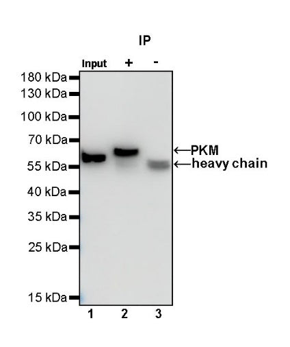 PKM Recombinant Rabbit mAb (S-812-20)