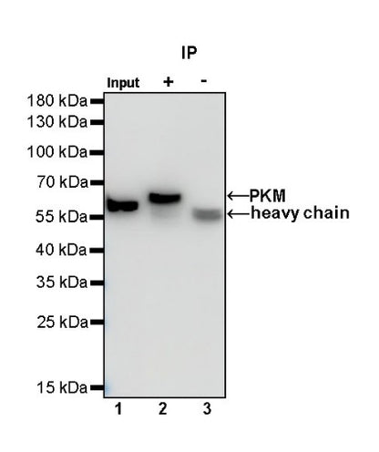 PKM Recombinant Rabbit mAb (S-812-20)