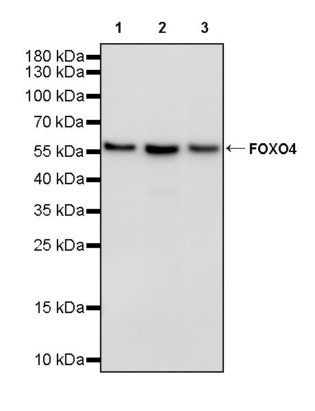 FOXO4 Recombinant Rabbit mAb (S-3527-19)