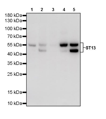 ST13 Recombinant Rabbit mAb (S-661-38)