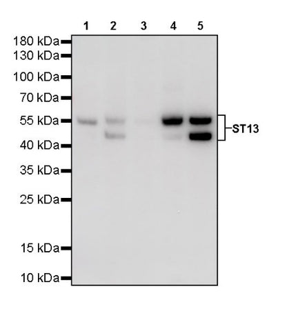 ST13 Recombinant Rabbit mAb (S-661-38)