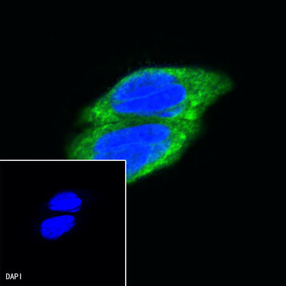 Beta III tubulin Recombinant Rabbit mAb (SDT-251-28)