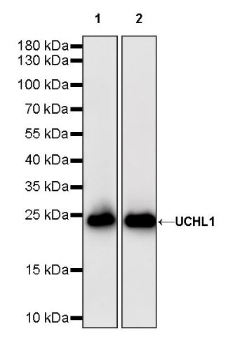 UCHL1 Recombinant Rabbit mAb (S-1765-38)
