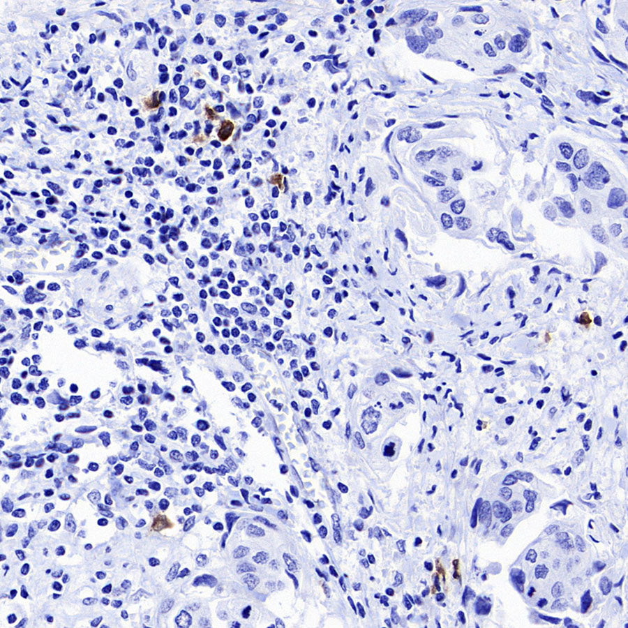 CLEC9A Recombinant Rabbit mAb (S-1904-154)
