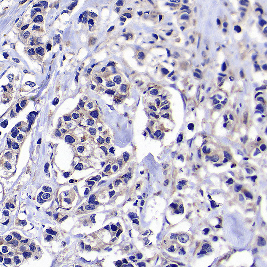 BMP4 Recombinant Rabbit mAb (S-3938-66)