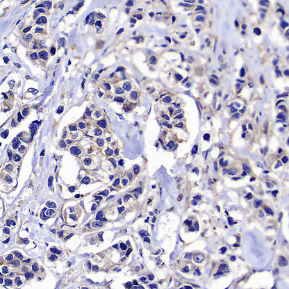BMP4 Recombinant Rabbit mAb (S-3938-66)