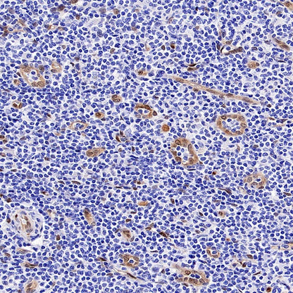 TAZ Recombinant Rabbit mAb (S-2812-102)