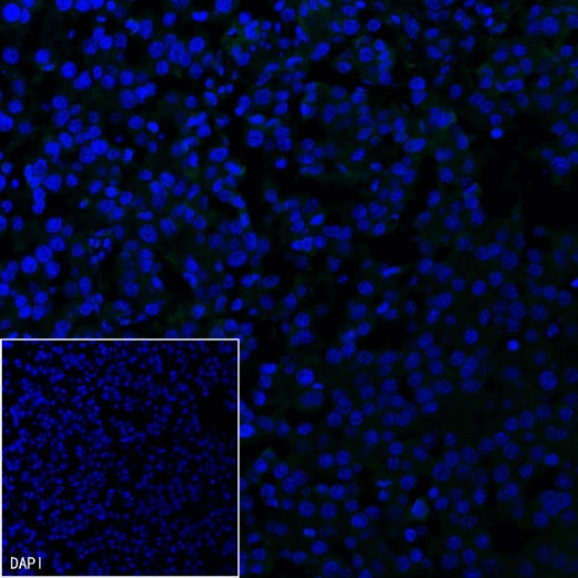 PAX8 Recombinant Rabbit mAb (SDT-R509)
