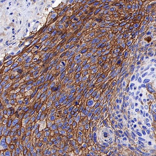 CD44v6 Recombinant Rabbit mAb (S-944-13)