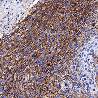 CD44v6 Recombinant Rabbit mAb (S-944-13)