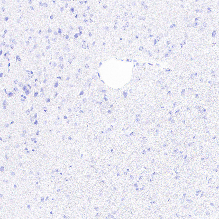Myoglobin Recombinant Rabbit mAb (S-6197)