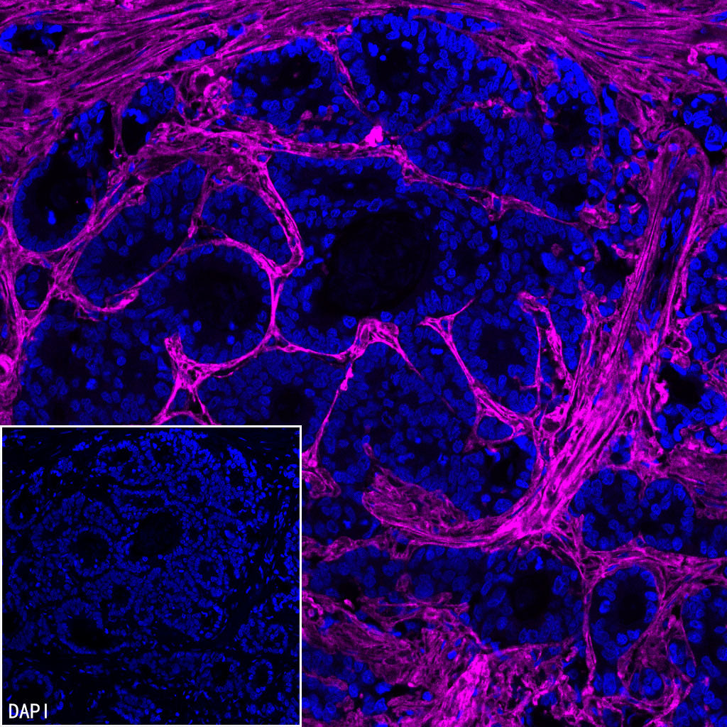 COL3A1 Recombinant Rabbit mAb (S-4338)