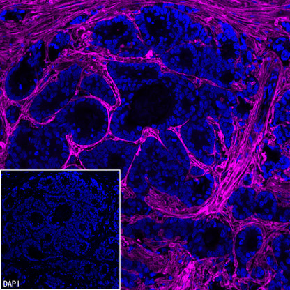 COL3A1 Recombinant Rabbit mAb (S-4338)