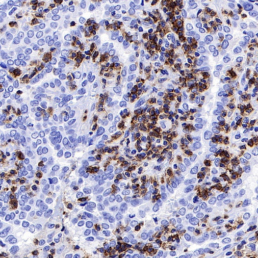 Mouse Anti-Human CD45RO Antibody (UCHL1)