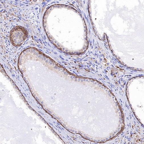 TRIM29 Recombinant Rabbit mAb (S-642-43)