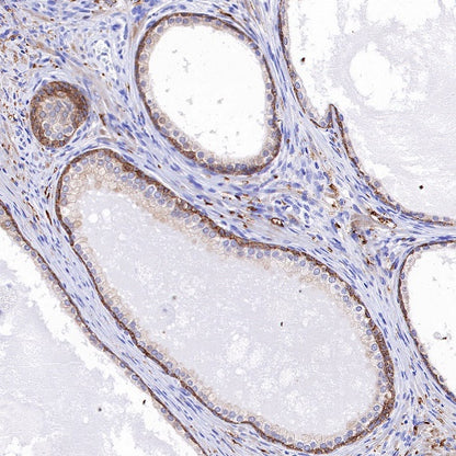 TRIM29 Recombinant Rabbit mAb (S-642-43)