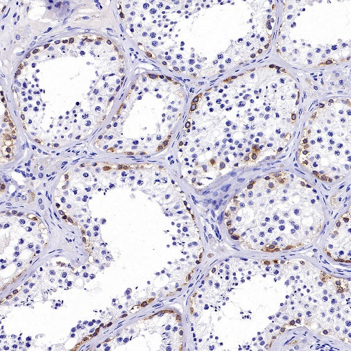 IGF2BP1 Recombinant Rabbit mAb (S-2947-19)