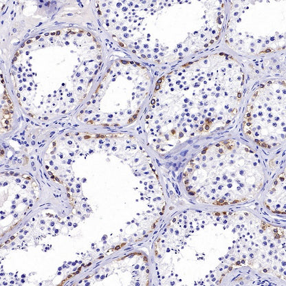 IGF2BP1 Recombinant Rabbit mAb (S-2947-19)