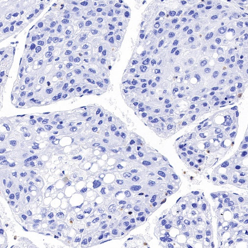 Claudin 4 Recombinant Rabbit mAb (SDT-814-53)