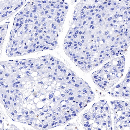 Claudin 4 Recombinant Rabbit mAb (SDT-814-53)