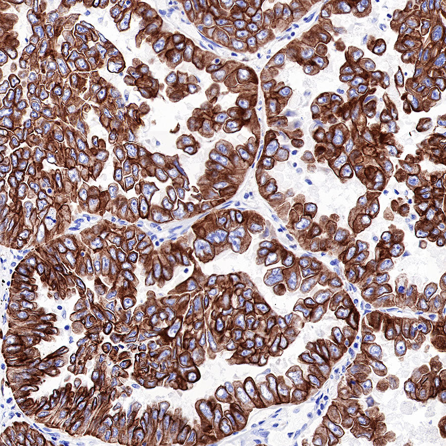 S-RMab® CK-Pan Recombinant Rabbit mAb,PBS Only (SDT-P001)