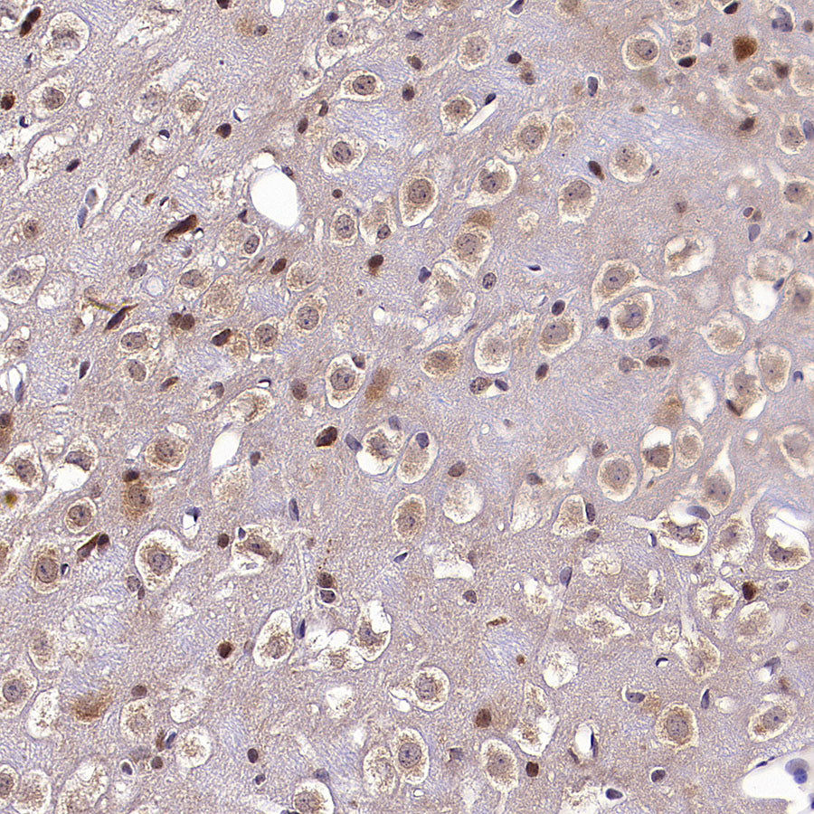 KCNMA1 Recombinant Rabbit mAb (S-2926-33)