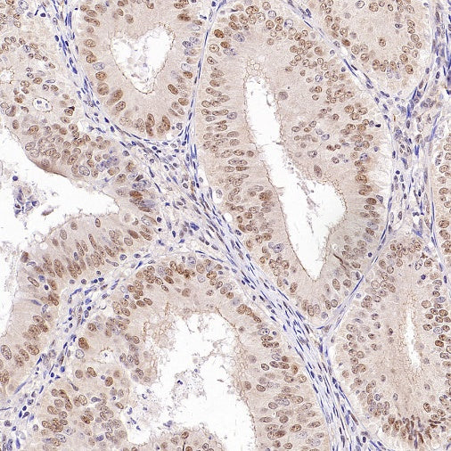 TDG Recombinant Rabbit mAb (S-3111-16)