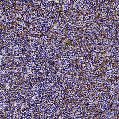 MX1 Rabbit Polyclonal Antibody