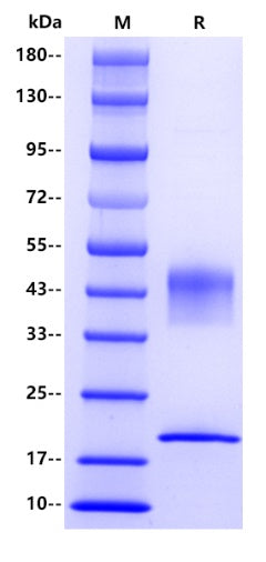 Haptoglobin His Tag Protein, Human