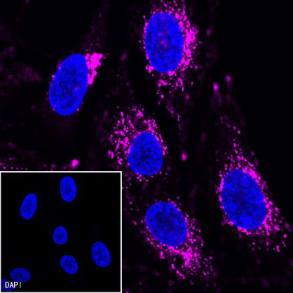 LAMP1 Recombinant Rabbit mAb (Alexa Fluor® 647 Conjugate) (SDT-405-39)