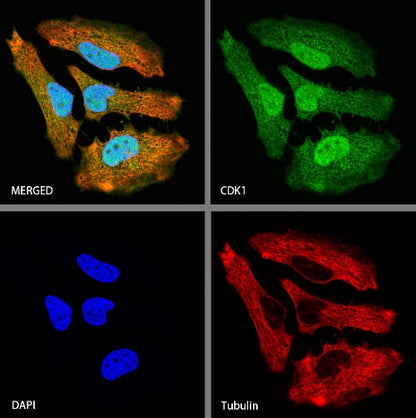 CDK1 Recombinant Rabbit mAb (S-1374-66)